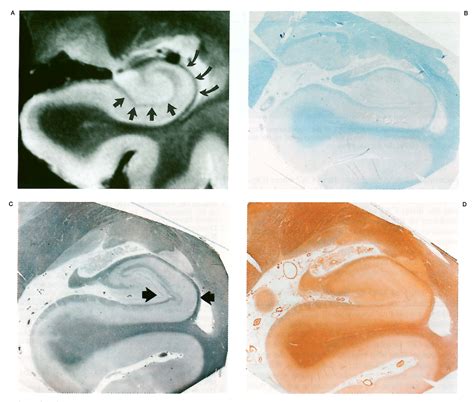 Figure 2 from Localization of a Myelin Layer within the Hippocampal ...