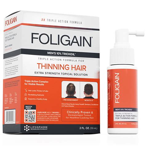 Foligain Mens Triple Action Complete Formula For Thinning Hair With 10 Trioxidil 2 Oz