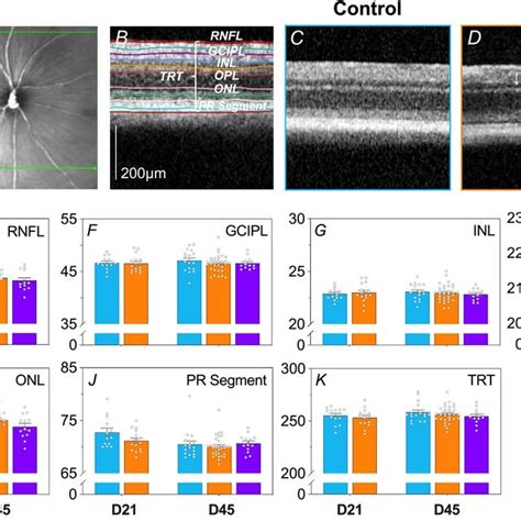 Effect Of Mptp And L Dopa On In Vivo Retinal Function Of The