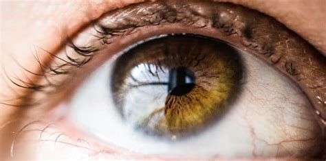 Qué Es El Edema Corneal O Córnea Opaca Causas Y Tratamientos Brill