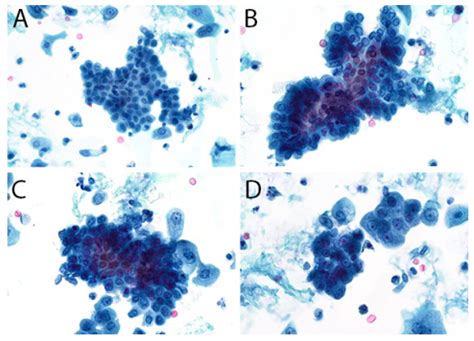 Diagnostics Free Full Text The Diagnostic Dilemma Of Urothelial