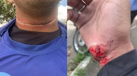 Veja V Deo Motociclista Fica Ferido Ap S Ser Atingido Por Fios Soltos