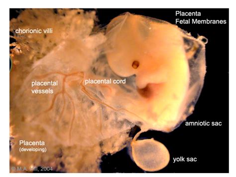 BGDA Practical Placenta Villi Development Embryology