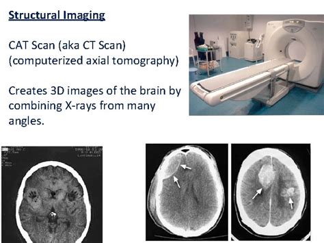 Types Of Brain Imaging Techniques Microelectrode Examines