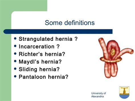 Inguinal Hernia Examination