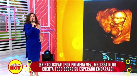 Melissa Klug Cuenta Detalles De Su Embarazo Y Muestra Su Ecografía En Vivo “es Un Deseo Hecho