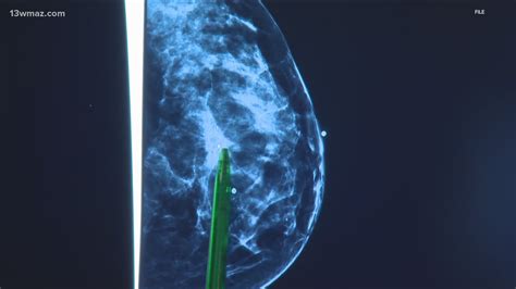 Fda Requires All Cancer Facilities To Give Breast Density Reports