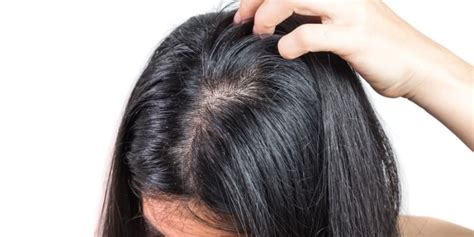 Excessive Hair Shedding Causes Treatments And Preventions