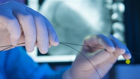 What Is Interventional Cardiology Doctors Tests Procedures And