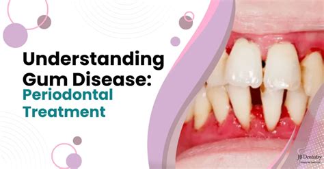 Understanding Gum Disease Periodontal Treatment