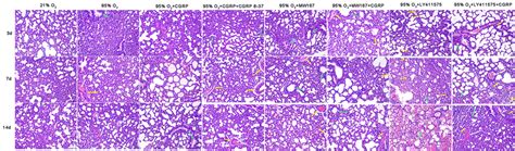 Histopathological Analysis Of Lung Tissues From Hyperoxia Induced Lung