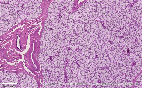 Low magnification micrograph illustrating the structure of a sublingual ...