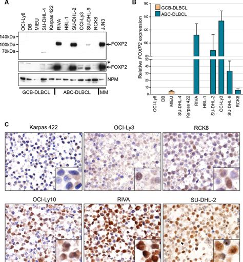 Foxp Is Expressed In Abc Dlbcl Cell Lines A Western Blotting Of