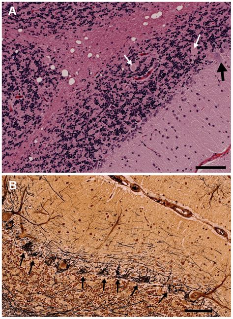 Sections Of The Cerebellum From An Affected Year Old Gordon Setter