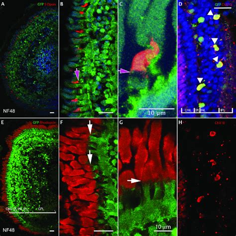 Multiple Double Immuno Labeling With Gfp Green Of Dio Transgenic