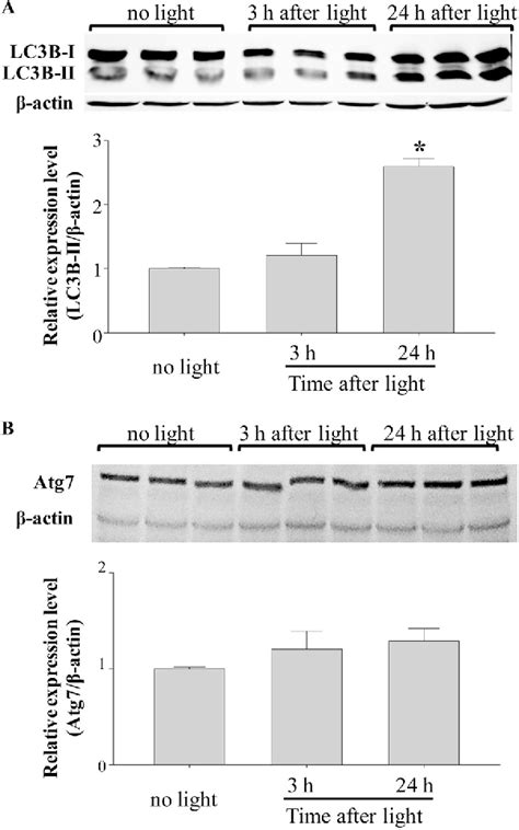 Figure From Autophagy Protects The Retina From Light Induced