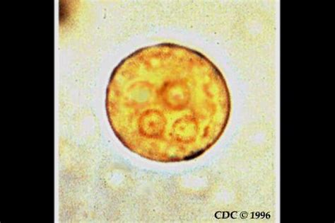 Entamoeba Histolytica Cyst In Stool Hamid Enami Flickr