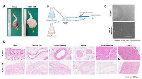 Psrc Ex Vivo Perfusion Decellularization Of Rat Hindlimb For Vascular