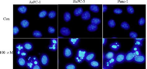 Silibinin Induced Cell Apoptosis In Aspc Panc And Bxpc Cells