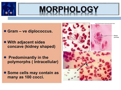 Neisseria Gonorrhoeae Lecture Iii Term Ppt