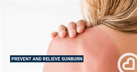 Prevent and relieve sunburn – – Familiprix