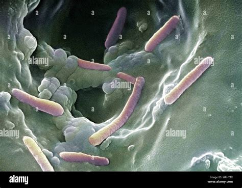 Pseudomonas Infection Stock Photos & Pseudomonas Infection Stock Images ...