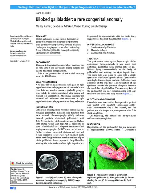 Pdf Bilobed Gallbladder A Rare Congenital Anomaly Satish Dharap