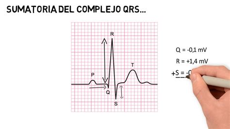 Cálculo Del Eje Eléctrico Del Corazón Youtube