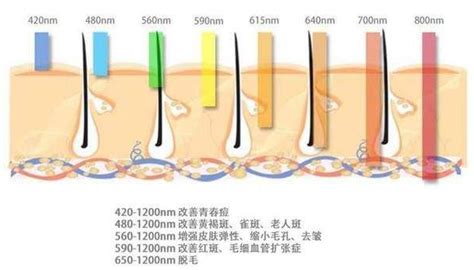 Doctorlu：强脉冲光的适应症和禁忌症以及术前准备 微医（挂号网）