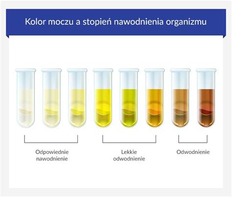 Co mogą oznaczać zmiany koloru moczu euroClinix