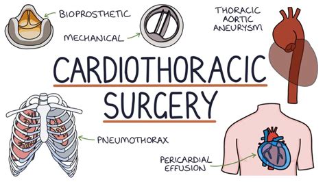 Cardiothoracic Surgery Zero To Finals