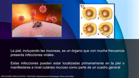 Virosis Herpes Virus VPH Molusco Contagioso PPT