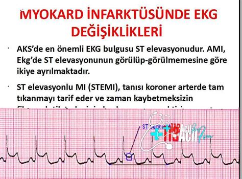 Akut Myokard İnfarktüsü Sunum Personel Sağlık Bakanlığı Haber 112acilfm Net Doktor Hemşire