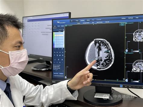 Ai Tech Helps Taiwan Doctors Identify Brain Tumors More Accurately