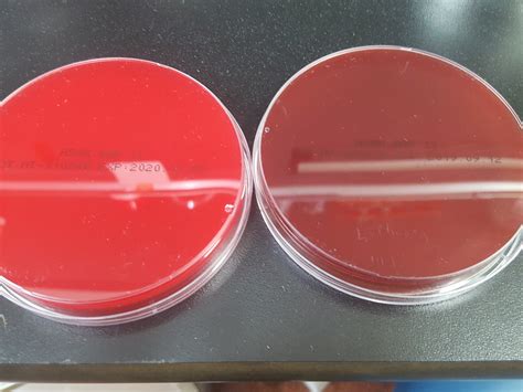 What Will Happen When We Leave Blood Agar Plates For Too Long With