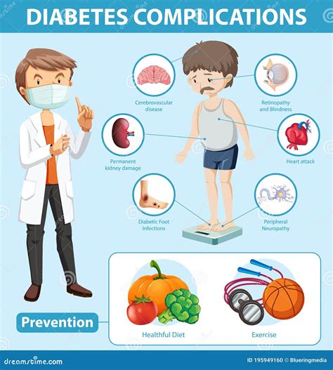 Medical Infographic Of Diabetes Complications And Preventions Stock