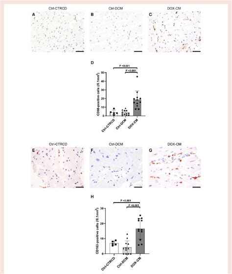 Cd68 And Cd163 Expression In Doxorubicin Induced Cardiomyopathy And