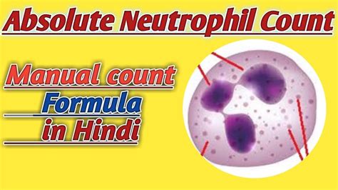 Abs Neutrophils High Symptoms at Robert Hatch blog