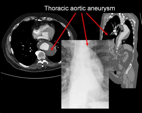 On Call Radiology Common Radiology Findings On Call And In The