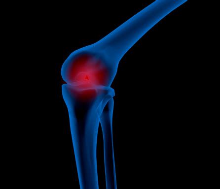 broken knee stock photo  image  backgrounds blue