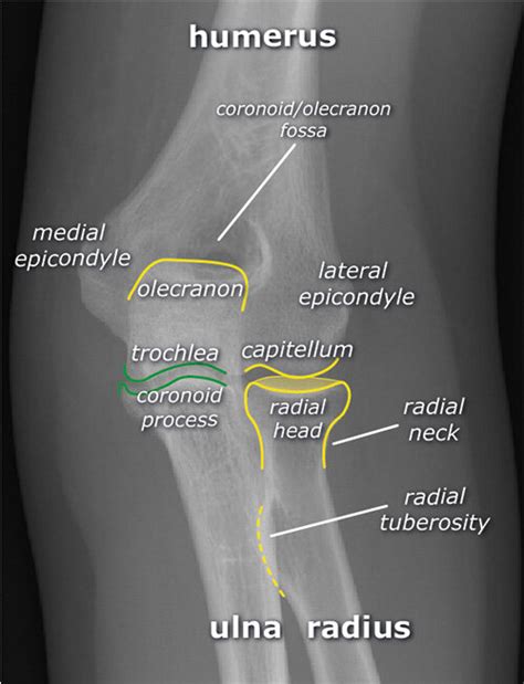 Normal Elbow Dr Wael Bayoud