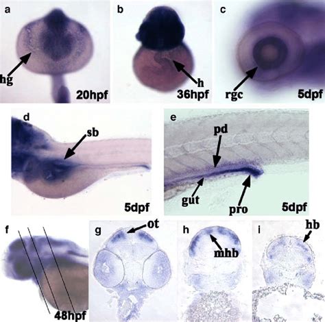 Whole Mount In Situ Hybridization Analysis Of Foxp Expression During