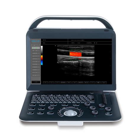 Welld C Ultrasound Color Doppler Ultrasound