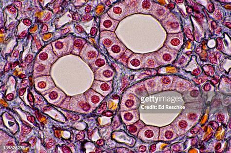 Simple Cuboidal Epithelium Labeled Basement Membrane