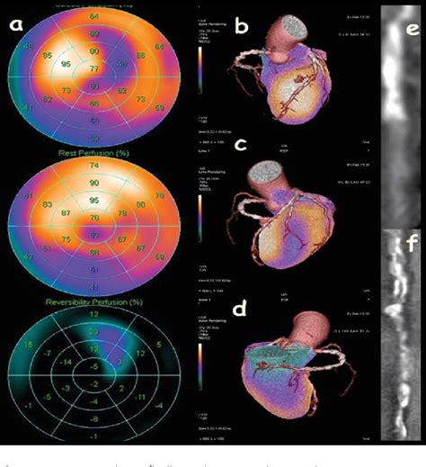 Figure 1 From Correlation Of Morphological And Functional Cardiac