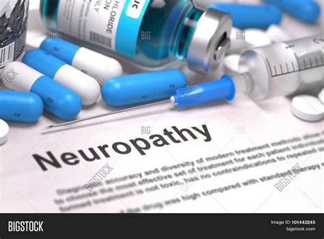 Neuropathy Diagnosis. Image & Photo (Free Trial) | Bigstock