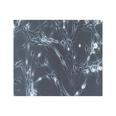 Human Primary Retinal Microvascular Endothelial Cells Supplier Aobious