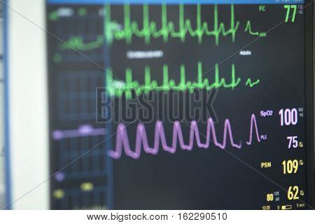 Electrocardiograph Image & Photo (Free Trial) | Bigstock