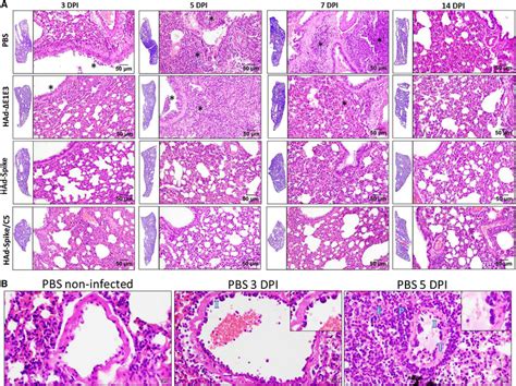 Representative Photomicrographs Of Histopathological Lesions Of Lung