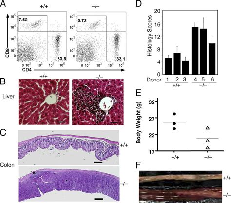 Induction Of Autoimmunity And Colitis By Adoptively Transferred Cyld− −